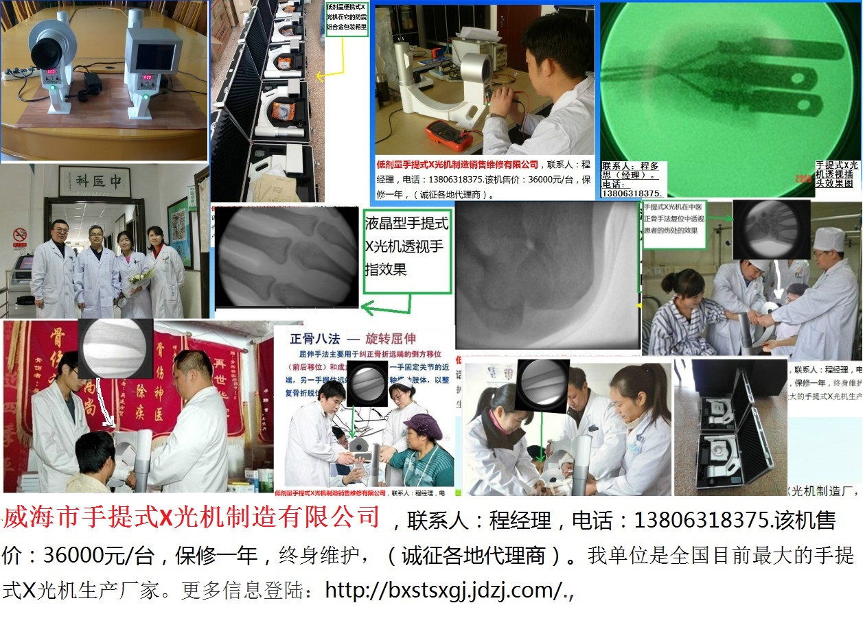 威海市手提式X光机便携式X光机便携式DR工业检视仪手提式X光机异物检视仪