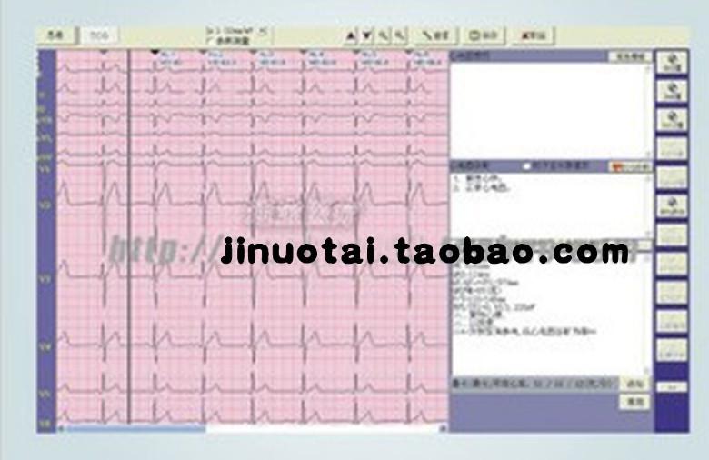 北京北京心电工作站/心电图机+心电软件/心电图心电工作站/心电图机心电软件