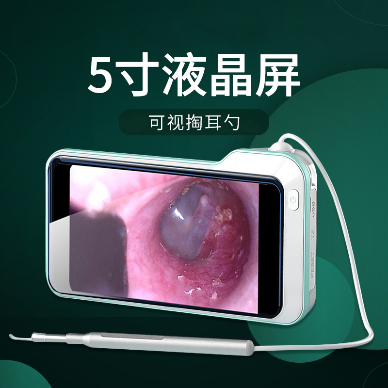 广东深圳发光可视耳勺挖耳朵工具 5寸液晶显示器掏耳勺采耳镜 冠眸内窥镜