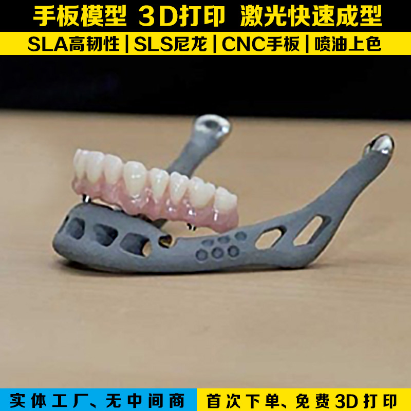 广东广东3d打印假牙模型深圳3d手板牙齿模型订制加工激光固化快速成型深圳模具配件加工制作深圳手板模型3d打印假牙模型